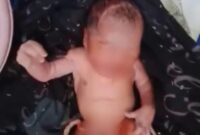 Foto: Seorang bayi laki-laki yang ditemukan warga Prenduan, di pinggir jalan