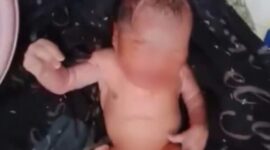 Foto: Seorang bayi laki-laki yang ditemukan warga Prenduan, di pinggir jalan