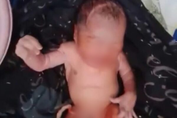 Foto: Seorang bayi laki-laki yang ditemukan warga Prenduan, di pinggir jalan